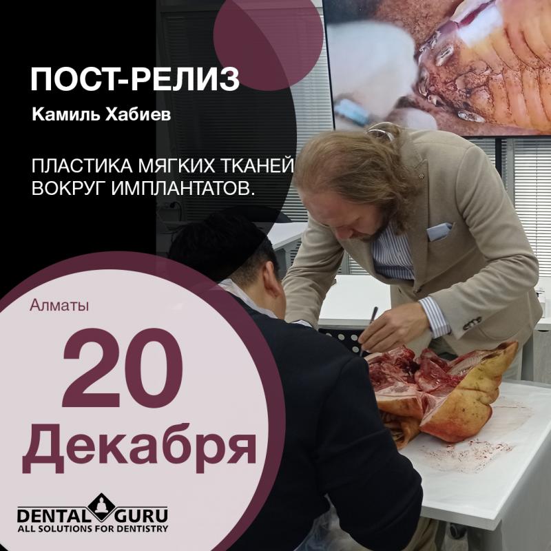 Пластика мягких тканей вокруг имплантатов. PRF в стоматологии. Курс в Казахстане