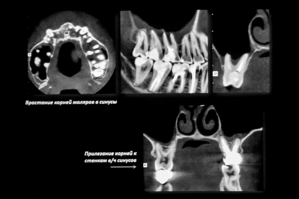 Курс Лучевая диагностика в стоматологии на основе КЛКТ,  как эффективного метода визуализации