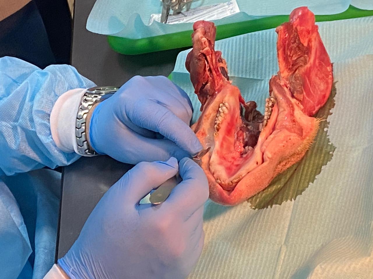 Дентальная имплантация с одновременной пластикой мягких тканей в сложных клинических случаях. 3 апреля 2021