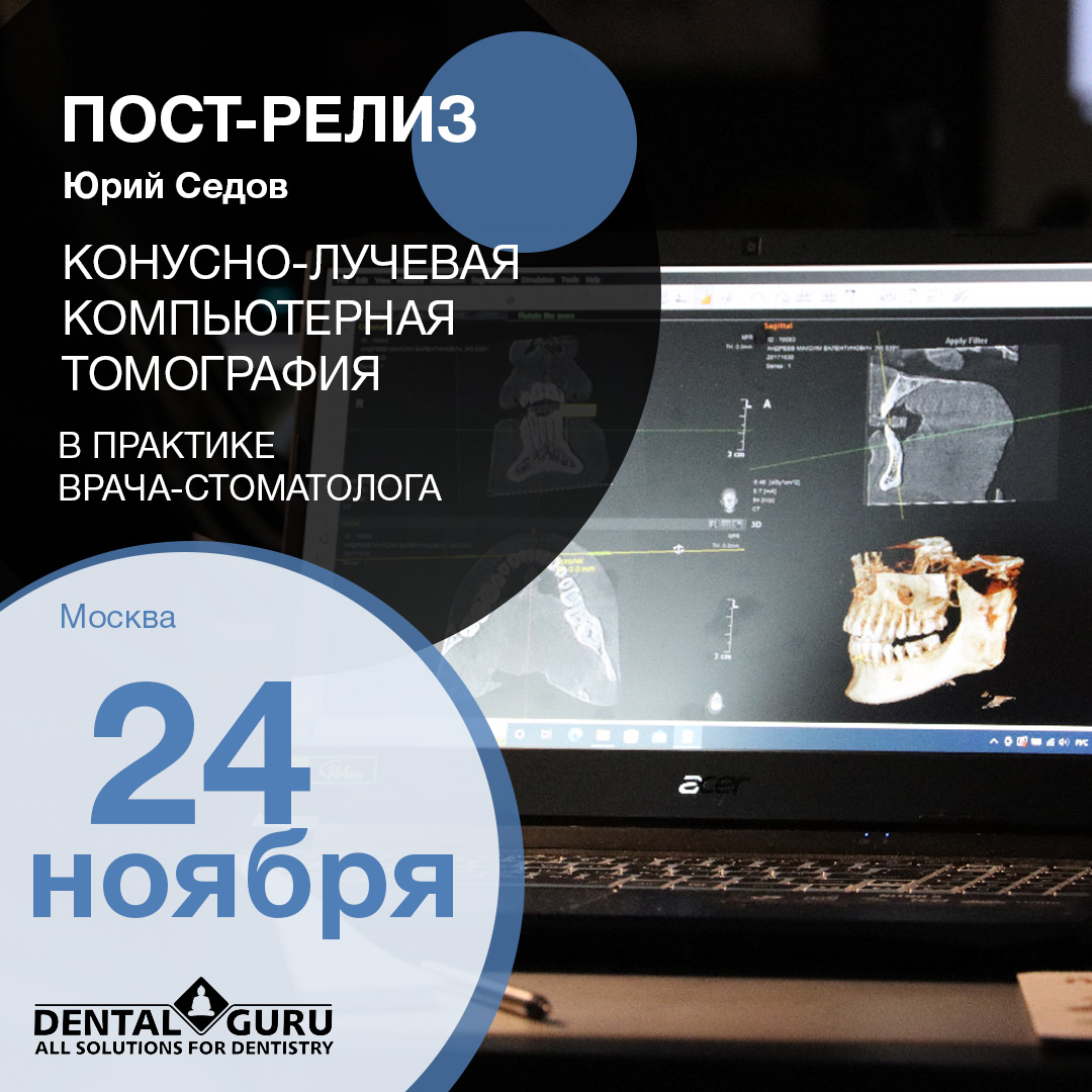 Конусно-лучевая компьютерная томография в практике врача-стоматолога