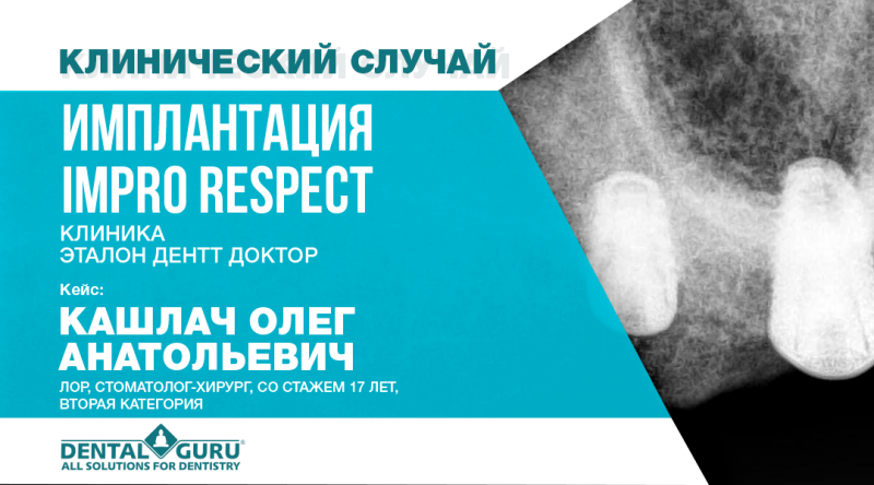 Имплантация IMPRO RESPECT 