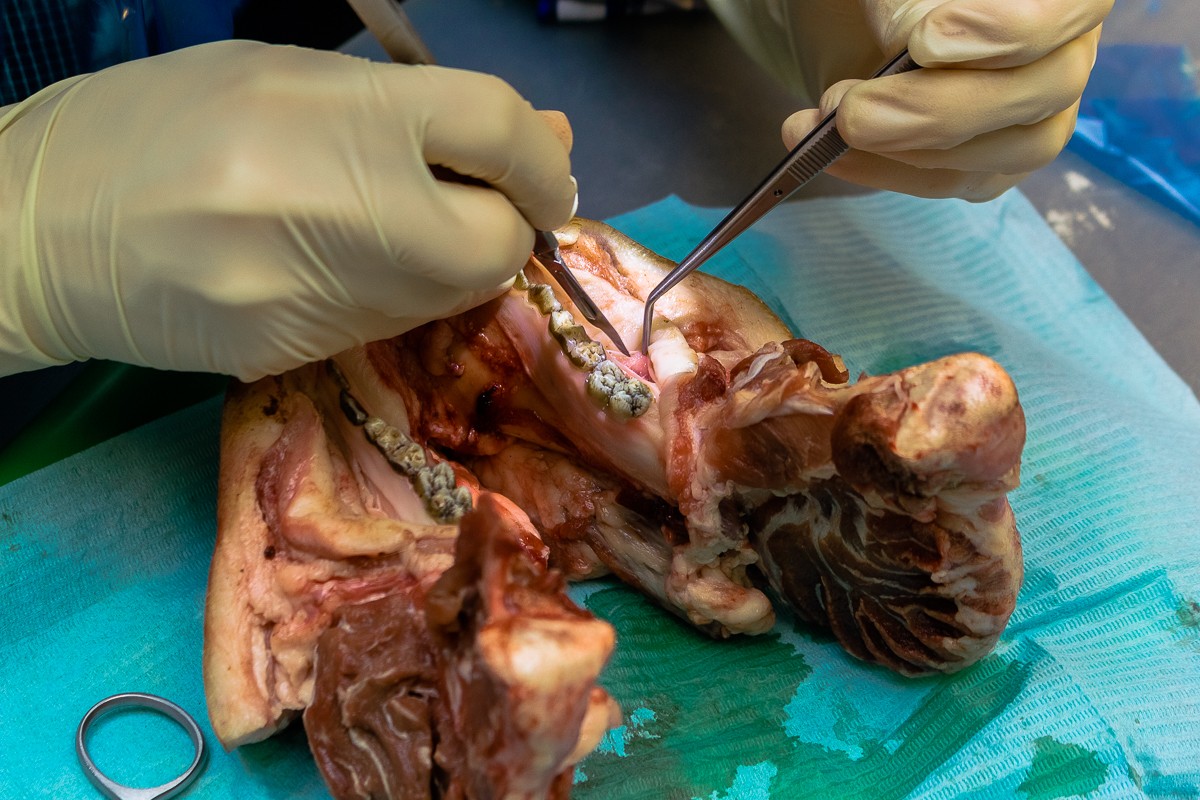 Пластика мягких тканей вокруг имплантатов. Морфологический подход - курс Виталия Панцулаи в УЦ Дентал Гуру.