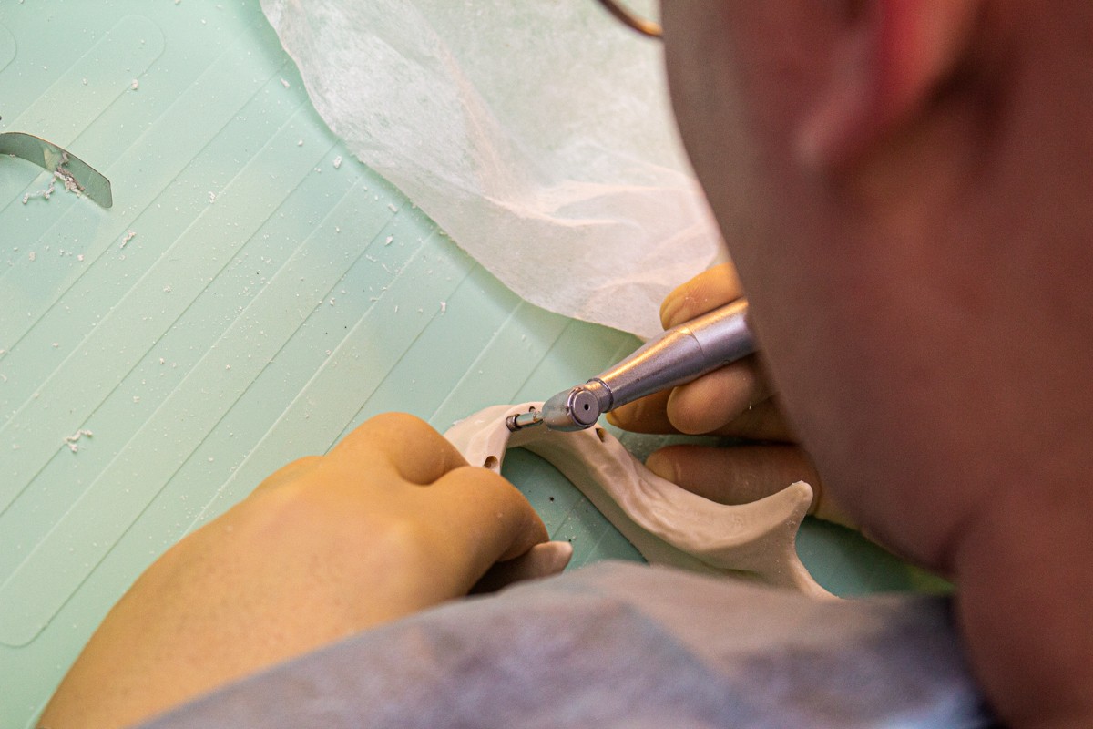 Стоматологическая реабилитация с помощью ангулированных имплантатов. 5 февраля 2020, Данилов Александр Алексеевич