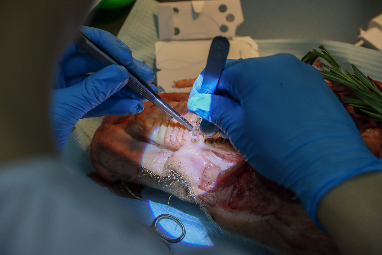 Пластика мягких тканей вокруг имплантатов. Морфологический подход