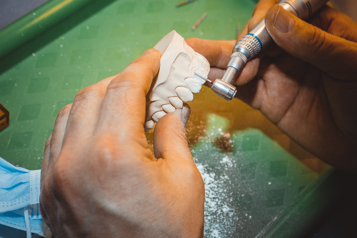 Препарирование зубов под цельнокерамические реставрации во фронтальном отделе, 26 февраля 2020г.