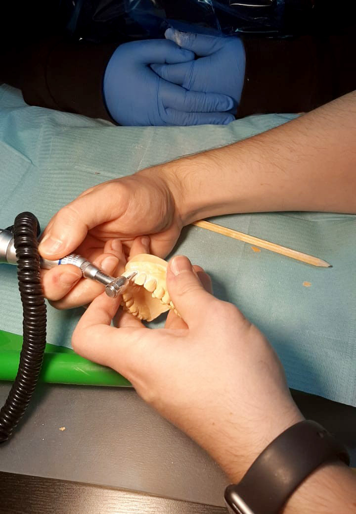 Препарирование зубов под цельнокерамические реставрации во фронтальном отделе. Пост-релиз 22 ноября