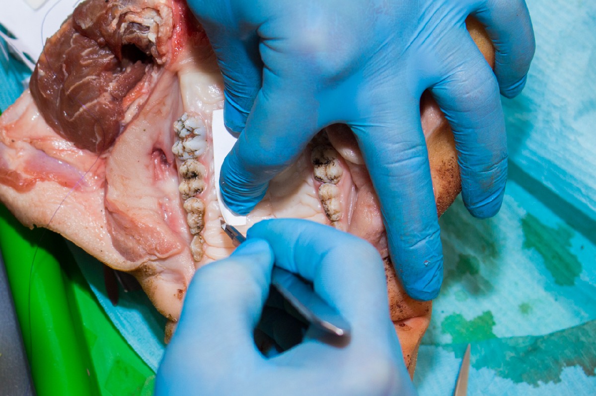 20-21 февраля 2020. Панцулая В.Г. Пластика мягких тканей вокруг имплантатов. Морфологический подход
