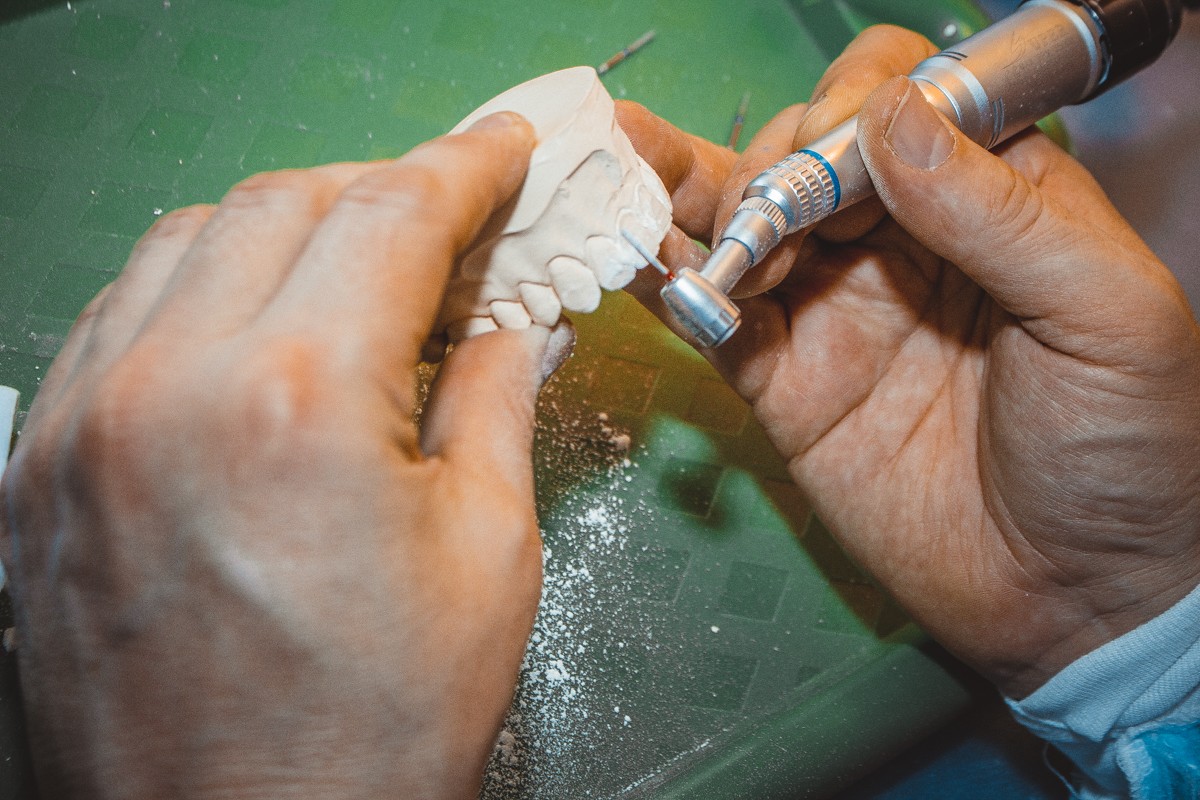 Препарирование зубов под цельнокерамические реставрации во фронтальном отделе, 26 февраля 2020г.