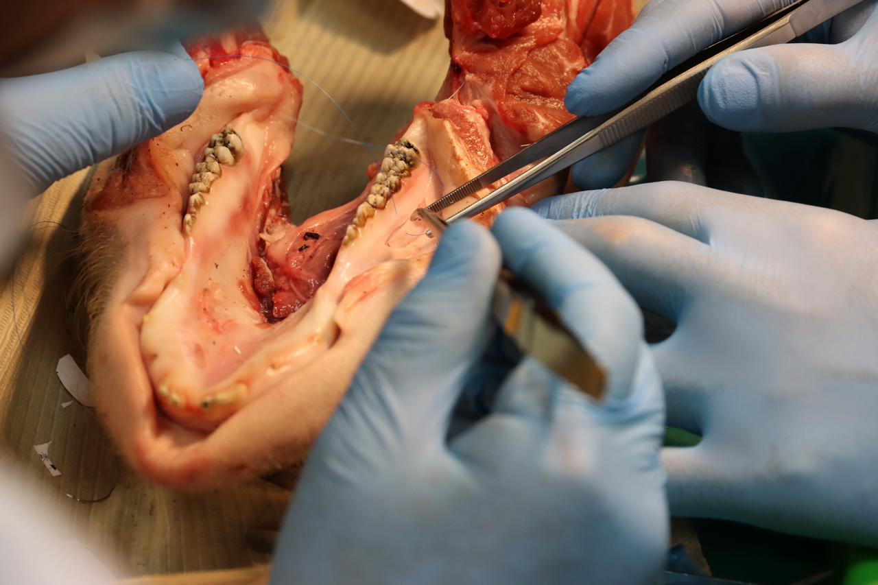 Дентальная имплантация с одновременной пластикой мягких тканей в сложных клинических случаях
