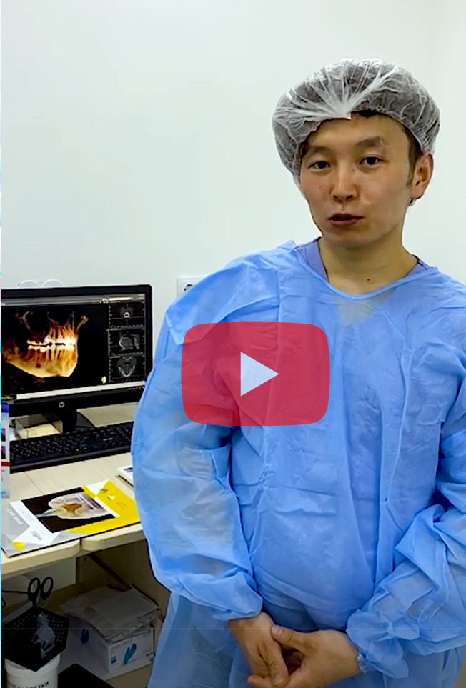 Видео-отзыв о мини-имплантатах Surgident SD-Mini-Ortho