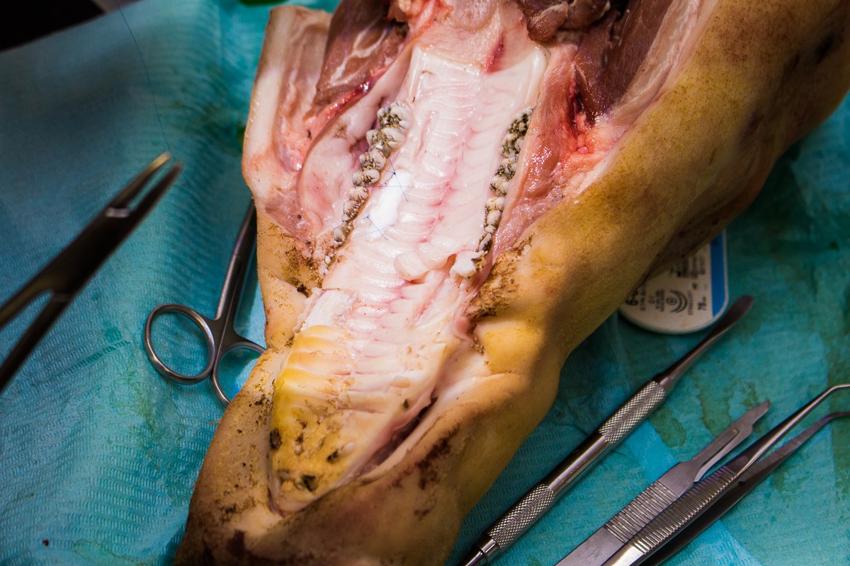 Пластика мягких тканей вокруг имплантатов. Морфологический подход - курс Виталия Панцулаи в УЦ Дентал Гуру.
