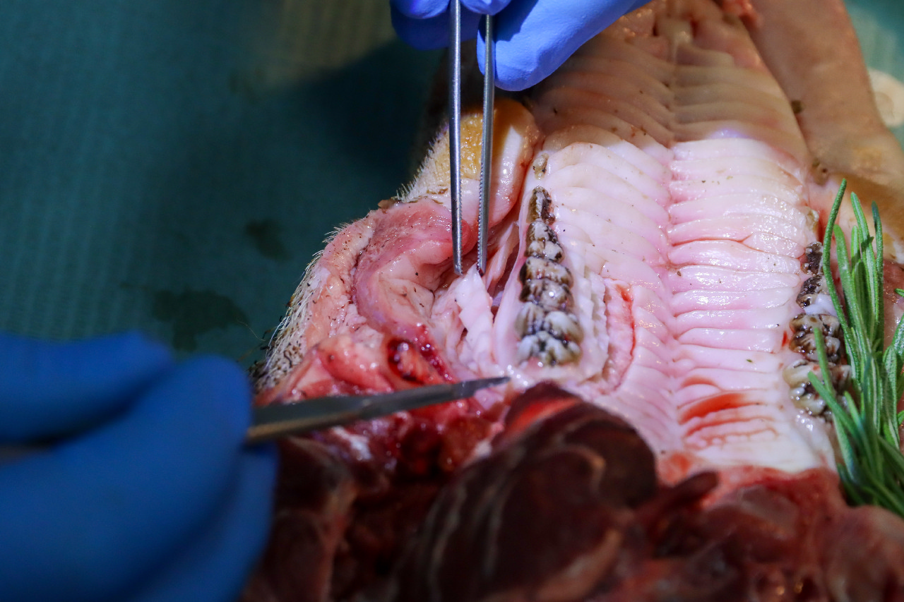 Пластика мягких тканей вокруг имплантатов. Морфологический подход