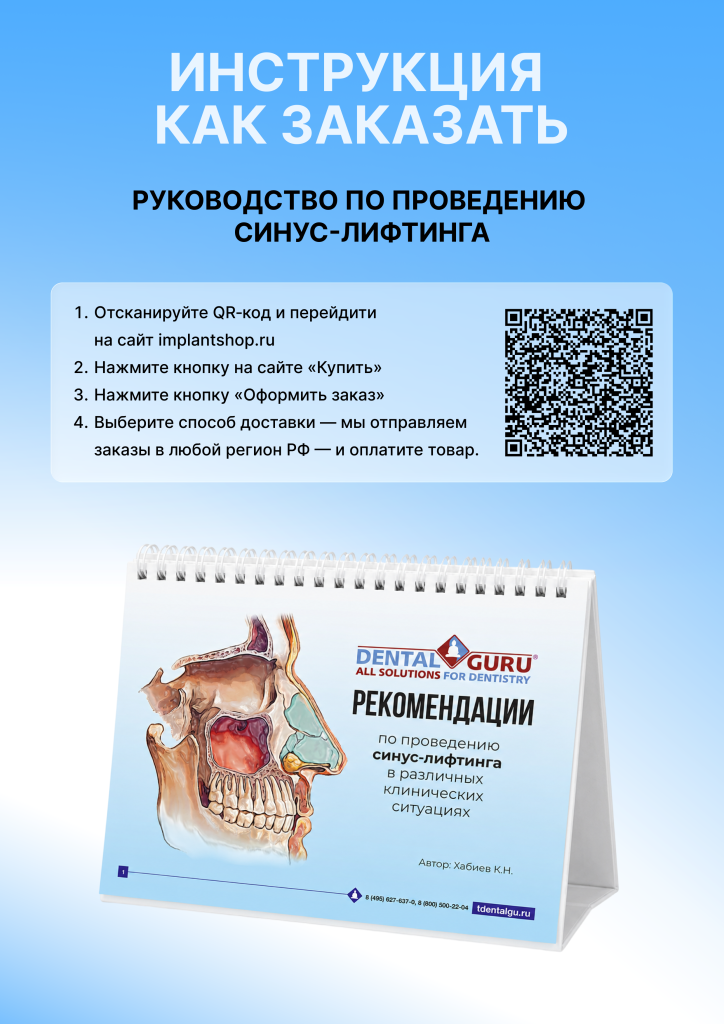 Руководство по синус-лифтингу