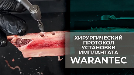 Хирургический протокол установки имплантата Warantec