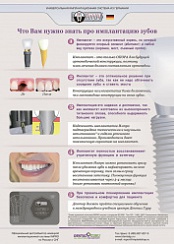 Что вам нужно знать про имплантацию зубов