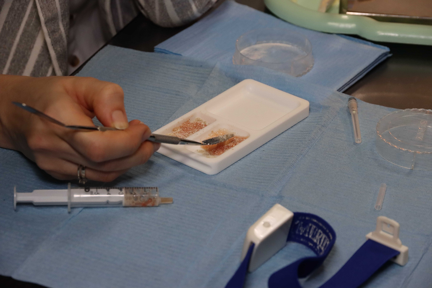 Плазмотерапия PRF в стоматологии